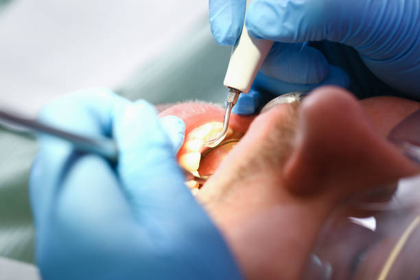 Best Emergency Dental Surgery in Huntsville, MO